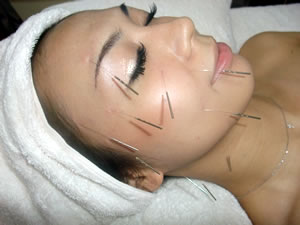 5BUNSET5D5B15D